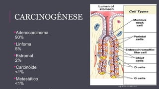 CARCINOGÊNESE 
Adenocarcinoma 
90% 
Linfoma 
5% 
Estromal 
2% 
Carcinóide 
<1% 
Metastático 
<1% 
Adenosquamous/squamous 
http : //www. c o lo ra d o . e du/ 
 