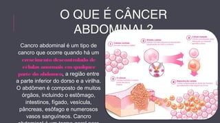 O QUE É CÂNCER 
ABDOMINAL? 
Cancro abdominal é um tipo de 
cancro que ocorre quando há um 
crescimento descontrolado de 
células anormais em qualquer 
parte do abdomen, a região entre 
a parte inferior do dorso e a virilha. 
O abdômen é composto de muitos 
órgãos, incluindo o estômago, 
intestinos, fígado, vesícula, 
pâncreas, esôfago e numerosos 
vasos sanguíneos. Cancro 
abdominal é um termo geral para 
 