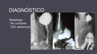 DIAGNÓSTICO 
Radiologia 
Rx contraste 
TAC abdominal 
 