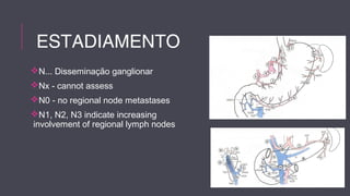 ESTADIAMENTO 
N... Disseminação ganglionar 
Nx - cannot assess 
N0 - no regional node metastases 
N1, N2, N3 indicate increasing 
involvement of regional lymph nodes 
 