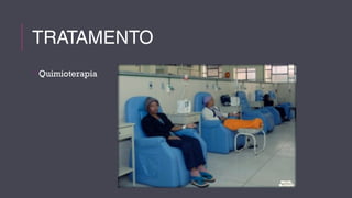 TRATAMENTO 
Quimioterapia 
 