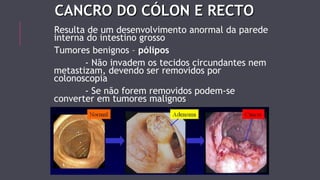 CCAANNCCRROO DDOO CCÓÓLLOONN EE RREECCTTOO 
Resulta de um desenvolvimento anormal da parede 
interna do intestino grosso 
Tumores benignos – pólipos 
- Não invadem os tecidos circundantes nem 
metastizam, devendo ser removidos por 
colonoscopia 
- Se não forem removidos podem-se 
converter em tumores malignos 
 