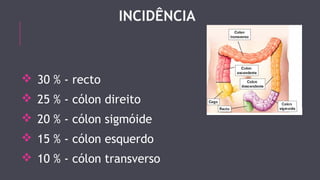 INCIDÊNCIA 
 30 % - recto 
 25 % - cólon direito 
 20 % - cólon sigmóide 
 15 % - cólon esquerdo 
 10 % - cólon transverso 
 
