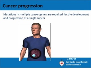 Cancer progression
Benign Tumour
In situ cancer
Invasive cancer
Metastatic
cancer
Mutations in multiple cancer genes are required for the development
and progression of a single cancer
 