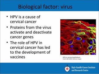 Biological factor: virus
• HPV is a cause of
cervical cancer
• Proteins from the virus
activate and deactivate
cancer genes
• The role of HPV in
cervical cancer has led
to the development of
vaccines HPV in cervical epithelium
Credit: MRC NIMR, Wellcome Images
 