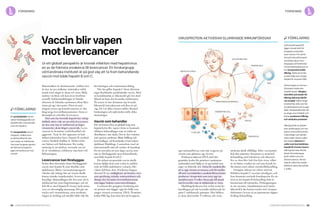 54 Cancerfondsrapporten 2013 Cancerfondsrapporten 2013 55
T-CELLER
MAKROFAG
DENDRITISK CELL
INFEKTERAD LEVERCELL
HBcAG
VACCIN MED DNA
HEPATIT B-VIRUS
DNA
MUSKELCELL
Matematiken är skrämmande: världen över
är mer än 500 miljoner människor infek­
terade med något av dessa två virus. Båda
smittar via blod, och kan även överföras
sexuellt. Infektionsförloppet är lömskt
eftersom de kliniska symtomen oftast låter
vänta på sig i decennier. Först så små­
ningom yttrar sig konsekvenserna av den
långvariga leverinflammationen i form av
skrumplever och/eller levercancer.
Den som har kronisk hepatit har mång­
dubbelt större risk att utveckla levercancer
än den som inte är infekterad; ju högre
virusnivåer, desto högre cancerrisk. Lever­
cancern är dessutom svårbehandlad och
aggressiv. Varje år dör uppemot en halv
miljon människor bara i hepatit B-orsakad
cancer. Särskilt drabbat är Afrika söder
om Sahara och Sydostasien. En vanlig
smittväg är att mödrar, ovetande om att
de är virusbärare, infekterar sina barn vid
förlossningen.
Levercancer kan förebyggas
Sedan flera decennier finns förebyggande
vaccin mot hepatit B, som skyddar mot
sjukdomen. Bättre vaccinationsprogram
i länder där många bär på viruset skulle
kunna minska insjuknandet i levercancer
betydligt. Behandlingen för den som väl är
infekterad har stora begränsningar och att
helt bli av med hepatit B-viruset tycks ännu
vara en oöverstiglig utmaning. Det går att
trycka ned virusnivåerna, men medicine­
ringen är livslång och medför både risk för
biverkningar och resistensutveckling.
När det gäller hepatit C finns däremot
inget skyddande, profylaktiskt vaccin. Med
en kombination av läkemedel går det dock
ibland att bota den kroniska infektionen.
På senare år har dessutom nya lovande
läkemedel introducerats och flera är på
väg. De två olika virusen ställer därmed
forskningen och sjukvården inför olika
utmaningar.
Vaccin som behandlar
För att kunna föra ett globalt krig mot
hepatit krävs fler vapen i form av kostnads­
effektiva behandlingar som är enkla att
distribuera i stor skala. Det är den visionen
som sporrar professor Matti Sällberg och
hans kolleger vid Karolinska Universitets­
sjukhuset Huddinge. I samarbete med ett
internationellt nätverk samlar de kunskap
för att utveckla ett nytt slags vaccin, som
inte är förebyggande utan behandlande,
mot både hepatit B och C.
Ett sådant terapeutiskt vaccin skulle
kunna hjälpa dem som redan är infekte­
rade att hålla sjukdomen i schack, eller
i bästa fall bota dem. Forskarna hoppas
därmed få nya möjligheter att bromsa viru­
sens spridning, minska smittsamheten och
dämpa den kroniska leverinflammation
som ligger bakom cancerutvecklingen.
I centrum för gruppens forskning står
ett protein som bygger upp det hölje som
omger virusets arvsmassa, DNA. Proteinet,
kallat HBcAg, kan sätta fart på kroppens
eget immunförsvar, som inte reagerar på
viruset som gömmer sig i levern.
Forskarna injicerar DNA med den
genetiska koden för proteinet i patientens
axelmuskel med hjälp av en specialnål som
avger en elektrisk stöt. Detta får muskelceller
att ta upp virusets arvsmassa, och förvandlas
till små vaccinfabriker; muskelcellerna börjar
producera virusprotein som retar upp im­
munförsvarets T-celler. Dessa går till attack
mot leverceller som är infekterade av virus.
Huddingeforskarna har redan testat be­
handlingen på tolv kroniskt infekterade he­
patit C-infekterade patienter. Hos hälften
av dem aktiverades T-cellerna och virus­
nivåerna sjönk tillfälligt. Efter vaccination
fick åtta patienter dessutom en standard­
behandling med interferon och ribavirin.
Sex av dem blev helt fria från virus, vilket
är ett bättre resultat än vad som kunde ha
förväntats med enbart standardbehandling.
Gruppen arbetar nu vidare med att
förbättra hepatit C-vaccinet ytterligare, och
kan dessutom använda kunskaperna för att
även ta sin hepatit B-behandling från la­
boratorium till människa. Förhoppningen
är att vaccinet, i kombination med andra
läkemedel, ska kunna trycka ned viruspro­
duktionen i levern så att patienterna slipper
livslång behandling.
Vaccin blir vapen
mot levercancer
Ur ett globalt perspektiv är kronisk infektion med hepatitvirus
en av de främsta orsakerna till levercancer. En forskargrupp
vid Karolinska Institutet är på god väg att ta fram behandlande
vaccin mot både hepatit B och C.
förklaring
Virusprotein AKTIVERAR slumrande immunförsvar förklaring
Ett profylaktiskt vaccin
verkar förebyggande och
skyddar den vaccinerade
mot att insjukna.
Ett terapeutiskt vaccin
fungerar i stället som
en behandling för den
som redan är infekterad.
Vaccinet fungerar genom
att aktivera kroppens
eget immunförsvar mot
viruset.
Vid kronisk hepatit B
ligger viruset dolt för
kroppens immunför-
svar i levern. För att få
fart på immunförsvaret
använder sig en fors-
kargrupp vid Karolinska
Universitetssjukhuset av
ett virusprotein kallat
HBcAg. Detta är en del
av det hölje som omger
hepatit B-virusets DNA.
Aktiveringen av immun­
försvaret måste ske
utanför levern. Ringfor­
mat DNA som kodar för
HBcAg injiceras därför
i en muskel. Nålen avger
en elektrisk stöt som får
muskelcellerna att ta upp
DNA. Muskelcellen blir då
en slags vaccinfabrik och
börjar producera HBcAg
och utsöndra proteinet.
HBcAg binds av patien-
tens antikroppar och tas
upp av immunförsvarets
makrofager och dendri-
tiska celler. Dessa celler
kan sedan aktivera T-
celler som kan bekämpa
hepatit B-viruset i levern.
HBcAg kan även binda
direkt till antikroppar
på B-cellers yta och
aktivera dessa. Aktive-
rade B-celler kan sedan
effektivt sätta fart på fler
T-celler.
forskningforskning
 