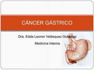 CÁNCER GÁSTRICO

Dra. Edda Leonor Velásquez Gutiérrez

          Medicina Interna
 