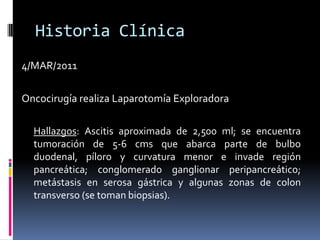 Historia Clínica4/MAR/2011Oncocirugía realiza Laparotomía ExploradoraHallazgos: Ascitis aproximada de 2,500 ml; se encuentra tumoración de 5-6 cms que abarca parte de bulbo duodenal, píloro y curvatura menor e invade región pancreática; conglomerado ganglionar peripancreático; metástasis en serosa gástrica y algunas zonas de colon transverso (se toman biopsias).