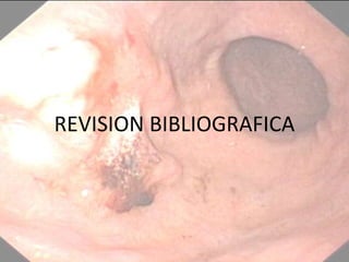 REVISION BIBLIOGRAFICA