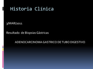 Historia Clínica3/MAR/2011Resultado  de Biopsias Gástricas		ADENOCARCINOMA GASTRICO DE TUBO DIGESTIVO