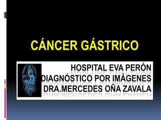CÁNCER GÁSTRICO
       HOSPITAL EVA PERÓN
 DIAGNÓSTICO POR IMÁGENES
 DRA.MERCEDES OÑA ZAVALA
 
