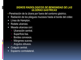 SIGNOS RADIOLOGICOS DE BENIGNIDAD DE LAS
                        ULCERAS GASTRICAS
- Penetración de la úlcera por fuera de...