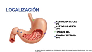LOCALIZACIÓN
CURVATURA MAYOR 3 5%
CURVATURA MENOR
20%
CARDIAS 25%

PÍLORO Y ANTRO 5060%

Dra. Noela Castro Vega , Prevalencia Del Adenocarcinoma Gástrico En El Hospital Oncológico De Solca De Loja. 2005 – 2008;

 