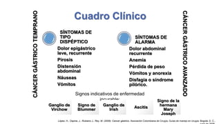 CÁNCER GÁSTRICO TEMPRANO

SÍNTOMAS DE
TIPO
DISPÉPTICO
Dolor epigástrico
leve, recurrente
Pirosis
Distensión
abdominal
Náuseas
Vómitos

SÍNTOMAS DE
ALARMA
Dolor abdominal
recurrente
Anemia
Pérdida de peso
Vómitos y anorexia
Disfagia o síndrome
pilórico.

Signos indicativos de enfermedad
incurable:
Ganglio de
Virchow

Signo de
Blummer

Ganglio de
Irish

Ascitis

CÁNCER GÁSTRICO AVANZADO

Cuadro Clínico

Signo de la
hermana
Mary
Joseph

López, H., Ospina, J., Rubiano J., Rey, M. (2009). Cancer gástrico. Asociación Colombiana de Cirugía, Guías de manejo en cirugía. Bogotá, D. C.,

 
