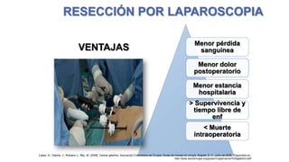RESECCIÓN POR LAPAROSCOPIA
VENTAJAS

Menor pérdida
sanguínea
Menor dolor
postoperatorio
Menor estancia
hospitalaria
> Supervivencia y
tiempo libre de
enf
< Muerte
intraoperatoria

López, H., Ospina, J., Rubiano J., Rey, M. (2009). Cancer gástrico. Asociación Colombiana de Cirugía, Guías de manejo en cirugía. Bogotá, D. C., junio de 2009. Disponible en:
http://www.ascolcirugia.org/guiasCirugia/cancer%20gastrico.pdf

 