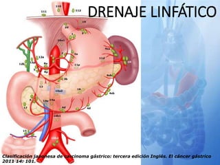 DRENAJE LINFÁTICO
Clasificación japonesa de carcinoma gástrico: tercera edición Inglés. El cáncer gástrico
2011 14: 101.
 