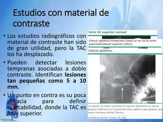 Estudios con material de
contraste
• Los estudios radiográficos con
material de contraste han sido
de gran utilidad, pero la TAC
los ha desplazado.
• Pueden detectar lesiones
tempranas asociadas a doble
contraste. Identifican lesiones
tan pequeñas como 5 a 10
mm.
• Un punto en contra es su poca
eficacia para definir
resecabilidad, donde la TAC es
muy superior.
 
