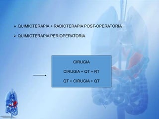  QUIMIOTERAPIA + RADIOTERAPIA POST-OPERATORIA
 QUIMIOTERAPIA PERIOPERATORIA
CIRUGIA
CIRUGIA + QT + RT
QT + CIRUGIA + QT
 