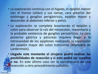 • La exploración continúa con el hígado, el epiplón menor
con el tronco celíaco y sus ramas, cara anterior del
estómago y ganglios perigástricos, epiplón mayor y
descender al abdomen inferior y pelvis.
• La exploración se completa levantando el epiplón y
colon para observar la raíz del mesocolon, mesenterio y
la probable existencia de ganglios periaórticos. La cara
posterior gástrica y páncreas requiere llegar a la
retrocavidad de los epiplones realizando la separación
del epiplón mayor del colon transverso (Maniobra de
Lardernnois).
• Llegado este momento el cirujano podrá evaluar las
posibilidades de resección y si esta podrá ser curativa
o no. En este último caso ver la conveniencia de una
resección u otro procedimiento paliativo.
 