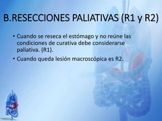 B.RESECCIONES PALIATIVAS (R1 y R2)
• Cuando se reseca el estómago y no reúne las
condiciones de curativa debe considerarse
paliativa. (R1).
• Cuando queda lesión macroscópica es R2.
 