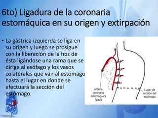 6to) Ligadura de la coronaria
estomáquica en su origen y extirpación
• La gástrica izquierda se liga en
su origen y luego se prosigue
con la liberación de la hoz de
ésta ligándose una rama que se
dirige al esófago y los vasos
colaterales que van al estómago
hasta el lugar en donde se
efectuará la sección del
estómago.
 