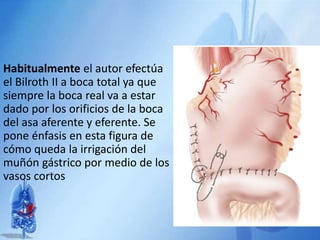 Habitualmente el autor efectúa
el Bilroth II a boca total ya que
siempre la boca real va a estar
dado por los orificios de la boca
del asa aferente y eferente. Se
pone énfasis en esta figura de
cómo queda la irrigación del
muñón gástrico por medio de los
vasos cortos
 