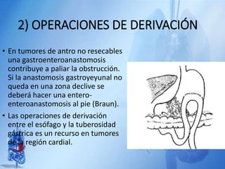 2) OPERACIONES DE DERIVACIÓN
• En tumores de antro no resecables
una gastroenteroanastomosis
contribuye a paliar la obstrucción.
Si la anastomosis gastroyeyunal no
queda en una zona declive se
deberá hacer una entero-
enteroanastomosis al pie (Braun).
• Las operaciones de derivación
entre el esófago y la tuberosidad
gástrica es un recurso en tumores
de la región cardial.
 