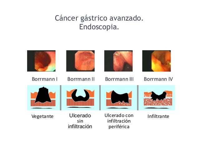 Sera metodos para bajar de peso naturalmente Pasa metodos para bajar de peso naturalmente explicacin esto