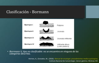 Clasificación - Bormann
• Borrmann V, tipo no clasificable: no se encuentra en ninguna de las
categorías descritas.
Herrera, A., Granados, M., (2010). Manual de oncología: procedimientos medico quirúrgicos.
Instituto Nacional de Cancerología. Cáncer gástrico. McGraw Hill.
 