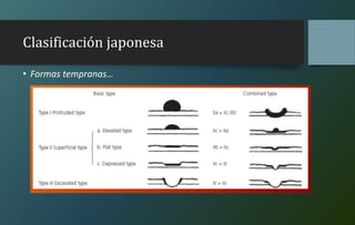 Clasificación japonesa
• Formas tempranas…
 