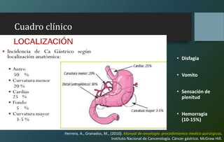 Cuadro clínico
• Disfagia
• Vomito
• Sensación de
plenitud
• Hemorragia
(10-15%)
Herrera, A., Granados, M., (2010). Manual de oncología: procedimientos medico quirúrgicos.
Instituto Nacional de Cancerología. Cáncer gástrico. McGraw Hill.
 