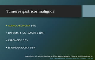 Tumores gástricos malignos
• ADENOCARCINOMA 95%
• LINFOMA 4- 5% (México 5-10%)
• CARCINOIDE 0.5%
• LEIOMIOSARCOMA 0.5%
Arana Reyes, J.C., Corona Bautista, A. (2013). Cáncer gástrico. E-journal UNAM. Obtenido de:
http://www.ejournal.unam.mx/rfm/no47-5/RFM47506.pdf
 