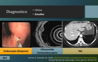 Diagnostico • Clínica
• Estudios
Endoscopia (biopsias)
Ultrasonido
transendoscopico
TAC
PET Herrera, A., Granados, M., (2010). Manual de oncología: procedimientos medico quirúrgicos.
Instituto Nacional de Cancerología. Cáncer gástrico. McGraw Hill.
 