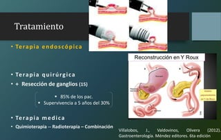 Tratamiento
• Terapia endoscópica
• Terapia quirúrgica
• + Resección de ganglios (15)
• Terapia medica
• Quimioterapia -- Radioterapia – Combinación
 85% de los pac.
 Supervivencia a 5 años del 30%
Villalobos, J., Valdovinos, Olivera (2012).
Gastroenterología. Méndez editores. 6ta edición
 