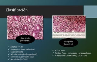 Clasificación
Bajo grado
(Indolentes) Alto grado
(agresivos)
 50 años * < 20
 Dispepsia – Dolor abdominal
 Engrosamiento
 Nódulos múltiples (empedrado)
 Erosiones superficiales (GC)
 Neoplasias (ULC PEP)
 60- 70 años
 Perdida Peso – hemorragia – masa palpable
 > Neoplasias ULCERADAS / EXOFITICAS
 