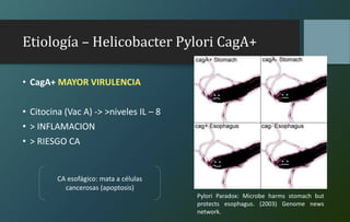 Etiología – Helicobacter Pylori CagA+
• CagA+ MAYOR VIRULENCIA
• Citocina (Vac A) -> >niveles IL – 8
• > INFLAMACION
• > RIESGO CA
CA esofágico: mata a células
cancerosas (apoptosis)
Pylori Paradox: Microbe harms stomach but
protects esophagus. (2003) Genome news
network.
 