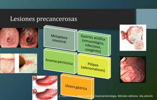 Lesiones precancerosas
Villalobos, J., Valdovinos, Olivera (2012). Gastroenterología. Méndez editores. 6ta edición
 