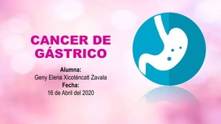 CANCER DE
GÁSTRICO
Alumna:
Geny Elena Xicoténcatl Zavala
Fecha:
16 de Abril del 2020
 