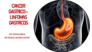 CANCER
GASTRICO–
LINFOMAS
GASTRICOS
EST. KEVIN AYALA
DR RAFAEL MUÑOZ OTERO
 