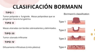 CANCER GASTRICO MEDICINA HUMANA CIRUGIAS | PDF