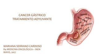 CANCER GÁSTRICO
TRATAMIENTO ADYUVANTE
MARIANA SERRANO CARDOSO
R4 MEDICINA ONCOLÓGICA – INEN
MAYO, 2017
 
