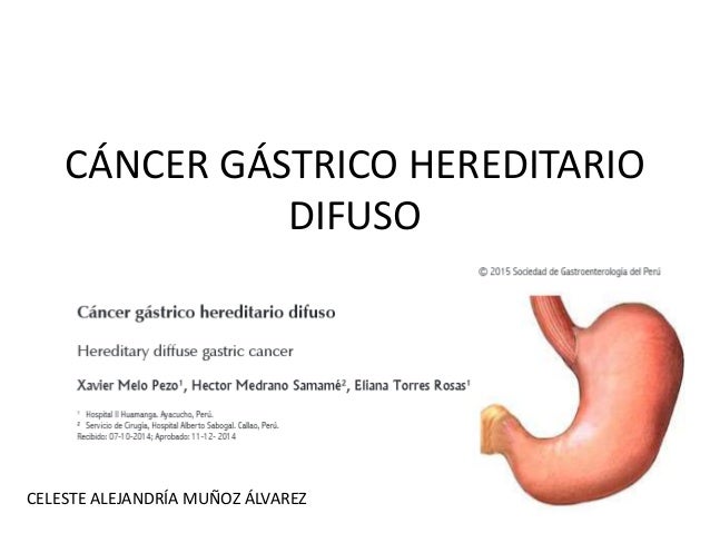 Cancer gastrico hereditario difuso Cancer gastrico hereditario difuso