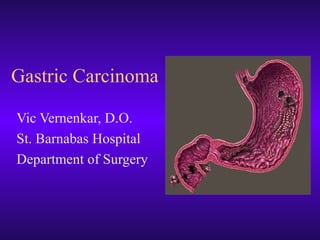 Gastric Carcinoma Vic Vernenkar, D.O. St. Barnabas Hospital Department of Surgery 