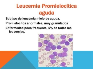 Subtipo de leucemia mieloide aguda.
Promielocitos anormales, muy granulados
Enfermedad poco frecuente. 5% de todas las
  leucemias.
 