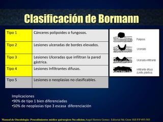 Clasificación de Bormann 
Tipo 1 Cánceres polipoides o fungosos. 
Tipo 2 Lesiones ulceradas de bordes elevados. 
Tipo 3 Lesiones Ulceradas que infiltran la pared 
gástrica. 
Tipo 4 Lesiones Infiltrantes difusas. 
Tipo 5 Lesiones o neoplasias no clasificables. 
Implicaciones 
•90% de tipo 1 bien diferenciadas 
•50% de neoplasias tipo 3 escasa diferenciación 
Manual de Oncolologia: Procedimientos médico quirurgicos 5ta edicion.Angel Herrera Gomez. Editorial Mc Graw Hill P.P 493-503 
 