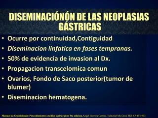 DISEMINACIÓNÓN DE LAS NEOPLASIAS 
GÁSTRICAS 
• Ocurre por continuidad,Contiguidad 
• Diseminacion linfatica en fases tempranas. 
• 50% de evidencia de invasion al Dx. 
• Propagacion transcelomica comun 
• Ovarios, Fondo de Saco posterior(tumor de 
blumer) 
• Diseminacion hematogena. 
Manual de Oncolologia: Procedimientos médico quirurgicos 5ta edicion.Angel Herrera Gomez. Editorial Mc Graw Hill P.P 493-503 
 