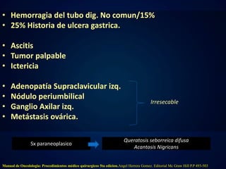 • Hemorragia del tubo dig. No comun/15% 
• 25% Historia de ulcera gastrica. 
• Ascitis 
• Tumor palpable 
• Ictericia 
• Adenopatía Supraclavicular izq. 
• Nódulo periumbilical 
• Ganglio Axilar izq. 
• Metástasis ovárica. 
Irresecable 
Sx paraneoplasico 
Queratosis seborreica difusa 
Acantosis Nigricans 
Manual de Oncolologia: Procedimientos médico quirurgicos 5ta edicion.Angel Herrera Gomez. Editorial Mc Graw Hill P.P 493-503 
 