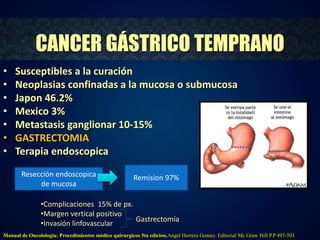 CANCER GÁSTRICO TEMPRANO 
• Susceptibles a la curación 
• Neoplasias confinadas a la mucosa o submucosa 
• Japon 46.2% 
• Mexico 3% 
• Metastasis ganglionar 10-15% 
• GASTRECTOMIA 
• Terapia endoscopica 
Resección endoscopica 
de mucosa 
Remision 97% 
•Complicaciones 15% de px. 
•Margen vertical positivo 
•Invasión linfovascular 
Gastrectomía 
Manual de Oncolologia: Procedimientos médico quirurgicos 5ta edicion.Angel Herrera Gomez. Editorial Mc Graw Hill P.P 493-503 
 