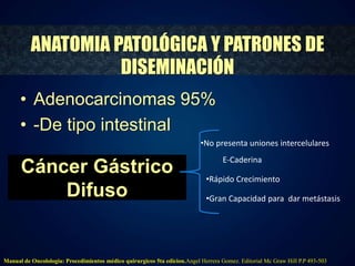 ANATOMIA PATOLÓGICA Y PATRONES DE 
DISEMINACIÓN 
• Adenocarcinomas 95% 
• -De tipo intestinal 
Cáncer Gástrico 
Difuso 
•No presenta uniones intercelulares 
E-Caderina 
•Rápido Crecimiento 
•Gran Capacidad para dar metástasis 
Manual de Oncolologia: Procedimientos médico quirurgicos 5ta edicion.Angel Herrera Gomez. Editorial Mc Graw Hill P.P 493-503 
 