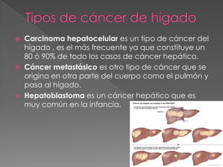  Carcinoma hepatocelular es un tipo de cáncer del
hígado , es el más frecuente ya que constituye un
80 ó 90% de todo los casos de cáncer hepático.
 Cáncer metastásico es otro tipo de cáncer que se
origina en otra parte del cuerpo como el pulmón y
pasa al hígado.
 Hepatoblastoma es un cáncer hepático que es
muy común en la infancia.
 